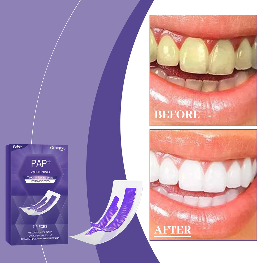 No-Sensitivity Whitening Strips (PAP)